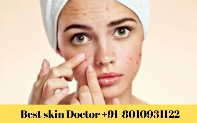 Best Skin Doctor in Kalkaji – 8010931122