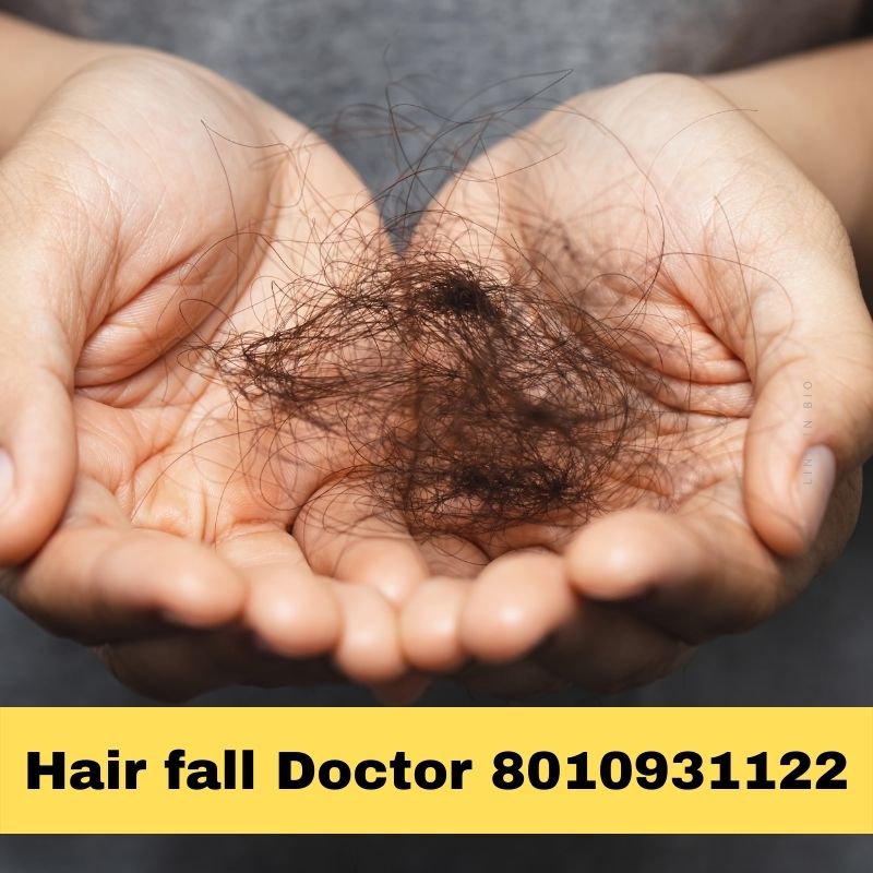 Hair fall specialist doctor in Sohna Sector 7 Gurgaon – 8010931122